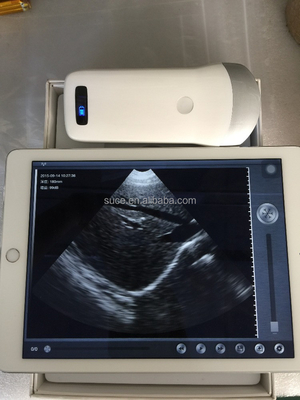 Wireless ultrasound probe iphone ultrasound probe uprobe-2(Convex) with ISO and CE