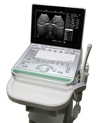 Portable ultrasound machine Laptop Ultrasound machine SU-7S with CE