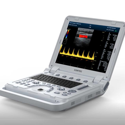 CONTEC CMS1700B Color Doppler Professional Diagnostic cardiology Ultrasonic Diagnostic System echocardiography machine p
