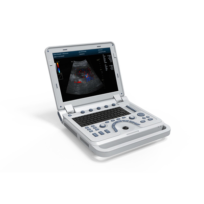 CONTEC CMS600P2 PLUS  portable ultrasound machine pseudo color doppler medical  ultrasound Pulse Spectral Doppler instru