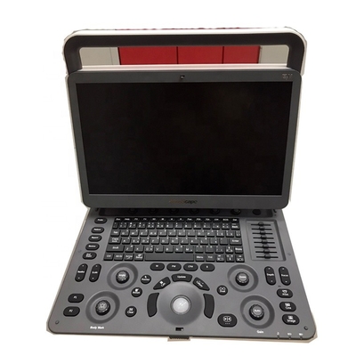 CW TDI software Sonoscape cardiac color doppler  Sonoscape E2  E3 ultrasound
