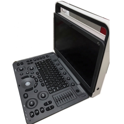CW TDI software Sonoscape cardiac color doppler  Sonoscape E2  E3 ultrasound
