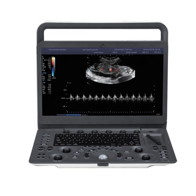 CW TDI software Sonoscape cardiac color doppler  Sonoscape E2  E3 ultrasound