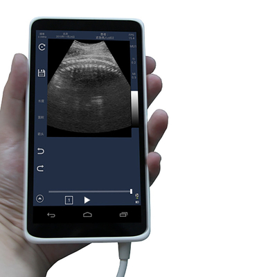Handheld Ultrasound Scanner convex transducer