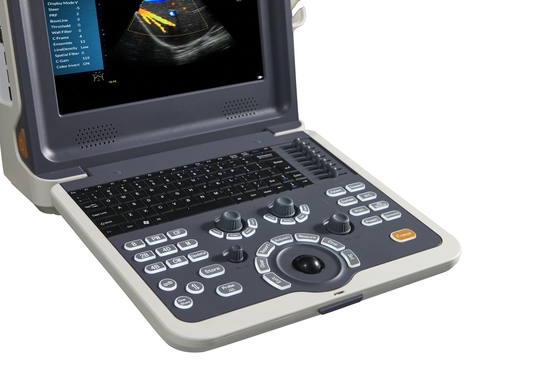 Factory price color doppler portable ultrasound scanner