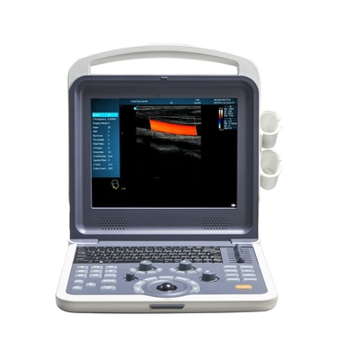 Factory price color doppler portable ultrasound scanner