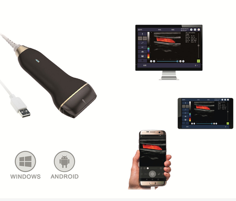 Mobile Smart USB Color Doppler Ultrasound Probe For Laptop