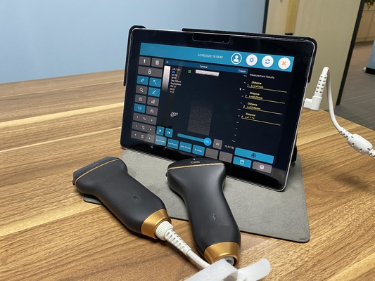 Mobile Smart USB Color Doppler Ultrasound Probe For Laptop
