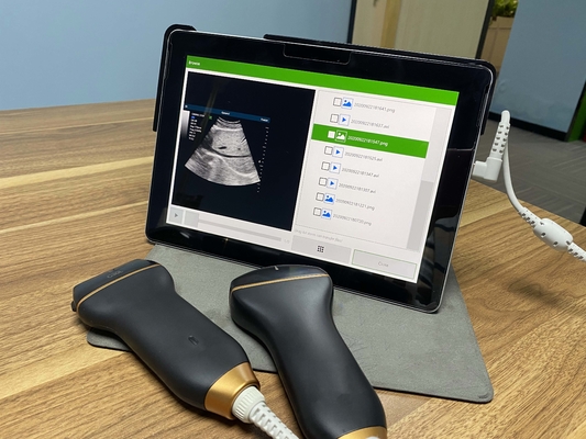 Mobile Smart USB Color Doppler Ultrasound Probe For Laptop