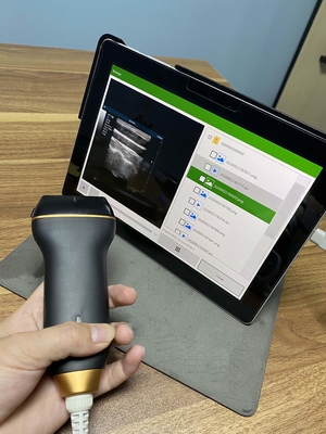 Mobile Smart USB Color Doppler Ultrasound Probe For Laptop