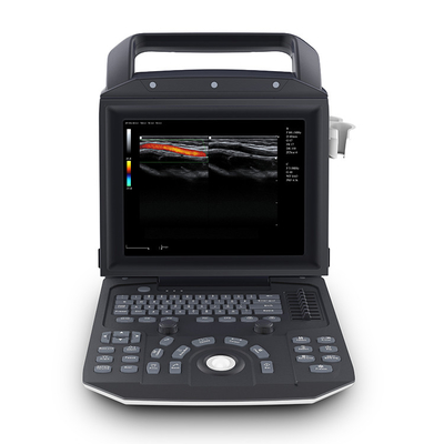 Portable Full Digital Color Doppler Ultrasound System Medical Scanner Ultrasound