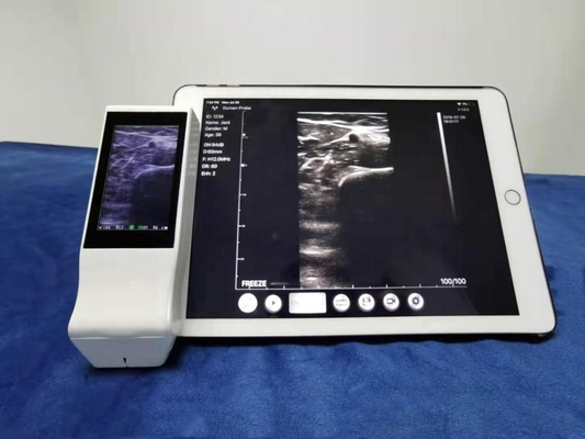 Portable wireless 7.5mhz linear doppler ultrasound probe
