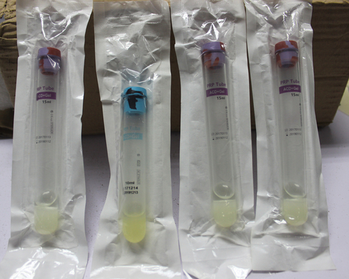 Prp Tube Platelet Rich Plasma 10ml 15ml Disposable Medical Consumables CE