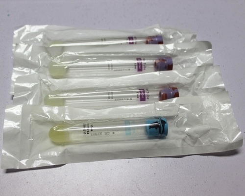 Prp Tube Platelet Rich Plasma 10ml 15ml Disposable Medical Consumables CE