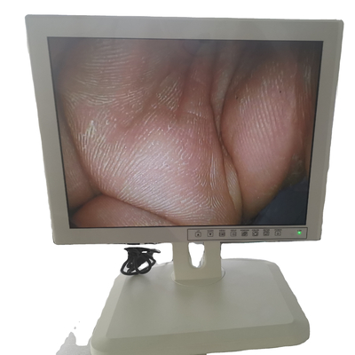 Japan technology Trolley type Digital Fiber gastroscope  Colposcope with video SY20