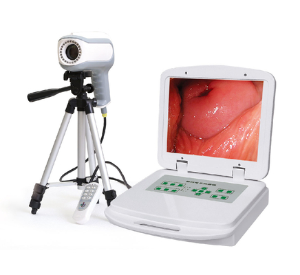 portable vagina camera  Colposcope automatic optical inspection System for Gynaecology