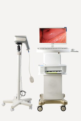 portable vagina camera  Colposcope automatic optical inspection System for Gynaecology