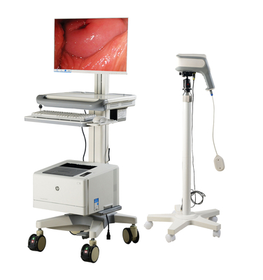 portable vagina camera  Colposcope automatic optical inspection System for Gynaecology