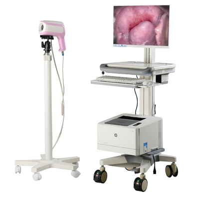 portable vagina camera  Colposcope automatic optical inspection System for Gynaecology