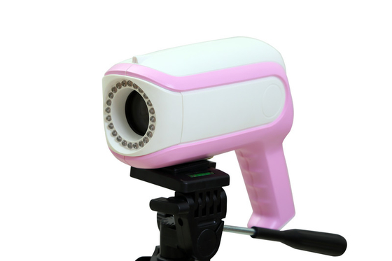 portable vagina camera  Colposcope automatic optical inspection System for Gynaecology