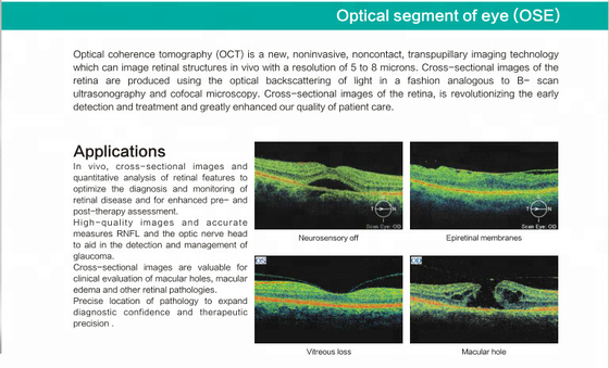 Spectral Domain OCT Optical Coherence Tomography for ophthalmology department