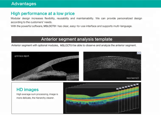 Spectral Domain OCT Optical Coherence Tomography for ophthalmology department