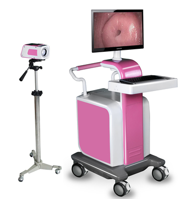 Digital Video Colposcope for hospitals