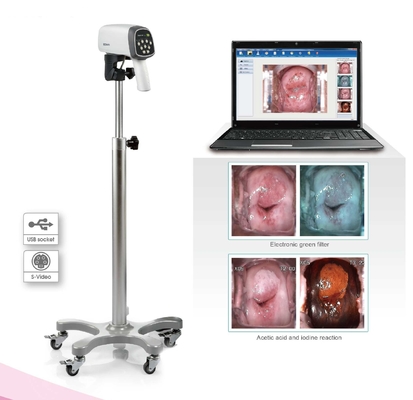 EDAN C3A&C6A Video Colposcope