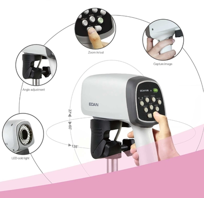 EDAN C3A&C6A Video Colposcope