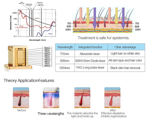 diode hair removal 3 Wavelength Diode Laser Hair Removal System 755nm 808nm 1064nm Beauty Care Device