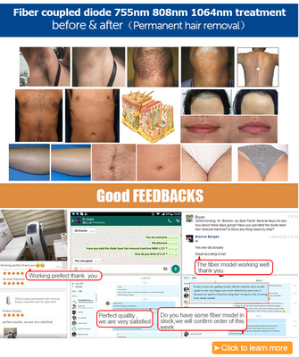 diode hair removal 3 Wavelength Diode Laser Hair Removal System 755nm 808nm 1064nm Beauty Care Device