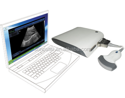 2020 Professional Portable Diagnostic Ultrasound System