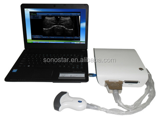 2020 Professional Portable Diagnostic Ultrasound System