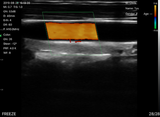 Wifi Ultrasound Probe Convex Linear Phasedarray 80/128/192 Color Doppler Wireless