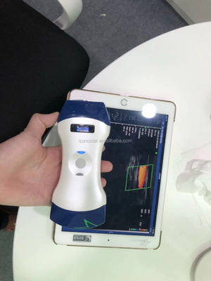 Wifi Ultrasound Probe Convex Linear Phasedarray 80/128/192 Color Doppler Wireless