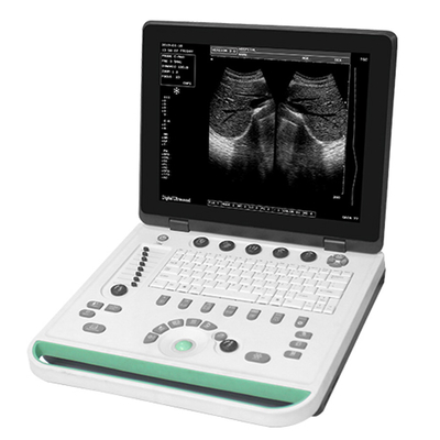 15 inch Cheap Hotsell SS-7 Vet Ultrasound Portable Machine Equipment High Image