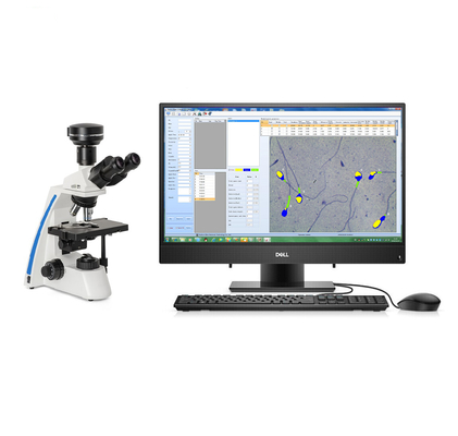 Semi Automatic Sperm Analysis System Computer Controlled Sperm Analyzer