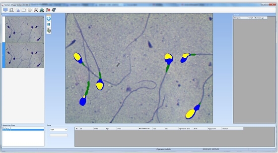 Semi Automatic Sperm Analysis System Computer Controlled Sperm Analyzer