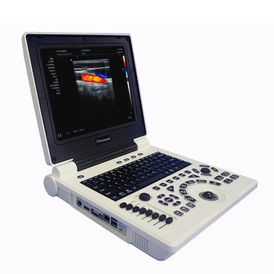Best Cheap Price Medical Ultrasound Diagnostic System Laptop Portable Color Doppler Ultrasound Machine for Hospital