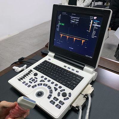 Best Cheap Price Medical Ultrasound Diagnostic System Laptop Portable Color Doppler Ultrasound Machine for Hospital