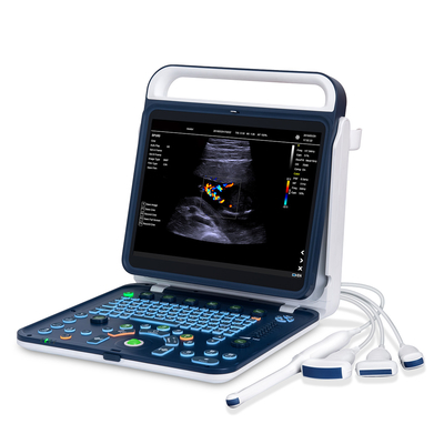 Color Doppler Portable Ultrasound Machine Medical USG PW CW DICOM Cardiac Probe Cardiology for Hospital Clinic