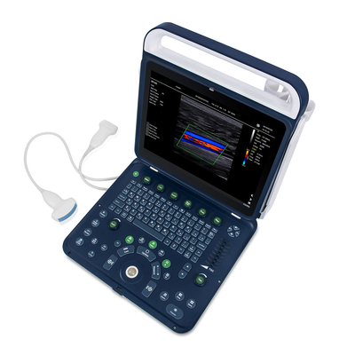 Color Doppler Portable Ultrasound Machine Medical USG PW CW DICOM Cardiac Probe Cardiology for Hospital Clinic