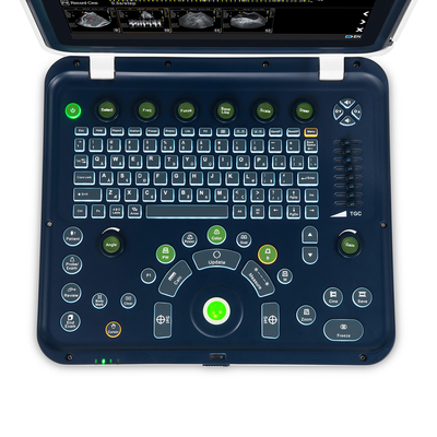 Color Doppler Portable Ultrasound Machine Medical USG PW CW DICOM Cardiac Probe Cardiology for Hospital Clinic