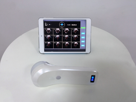 Portable 4D Wireless Bladder Scanner WIFI Ultrasound Probe for Evaluation of Residual Quality After Urination