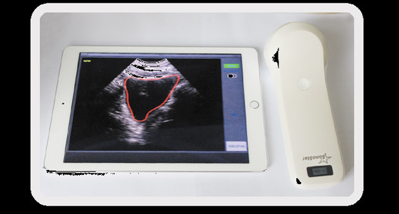Portable 4D Wireless Bladder Scanner WIFI Ultrasound Probe for Evaluation of Residual Quality After Urination