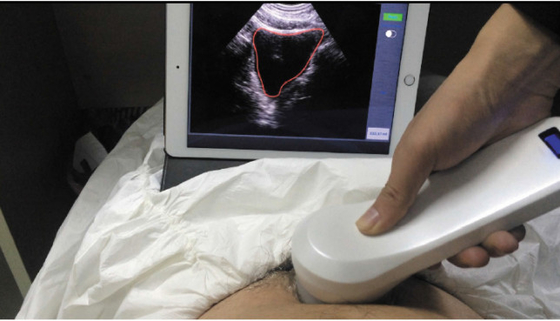 Portable 4D Wireless Bladder Scanner WIFI Ultrasound Probe for Evaluation of Residual Quality After Urination