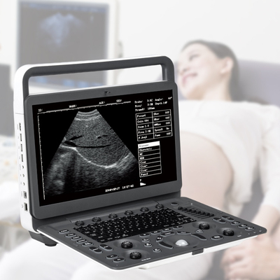 Sonoscape E2 Ecografo Cardiac Vascular Diagnosis B/ 2B/ 4B/ M/ Color Doppler Ultrasound Machine Requipo De Ultrasonido