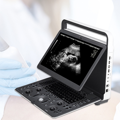 Sonoscape E2 Ecografo Cardiac Vascular Diagnosis B/ 2B/ 4B/ M/ Color Doppler Ultrasound Machine Requipo De Ultrasonido