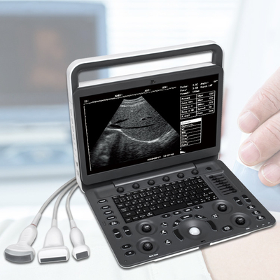 Sonoscape E2 Ecografo Cardiac Vascular Diagnosis B/ 2B/ 4B/ M/ Color Doppler Ultrasound Machine Requipo De Ultrasonido
