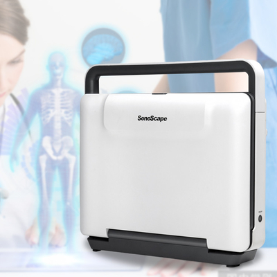 Sonoscape E2 Ecografo Cardiac Vascular Diagnosis B/ 2B/ 4B/ M/ Color Doppler Ultrasound Machine Requipo De Ultrasonido